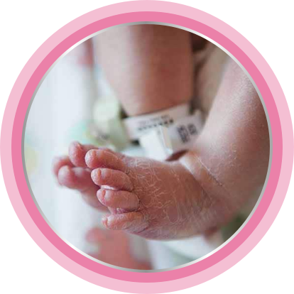 Using nappy cream helps relieve baby’s skin irritation